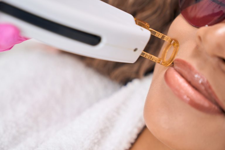 Depilación láser facial en Valencia